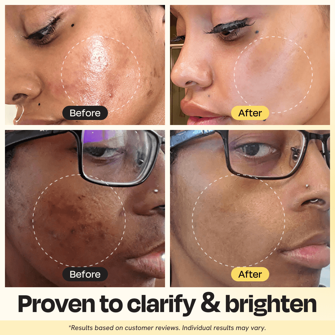 Vitamin C Clay Mask lifestyle - PuraVeil