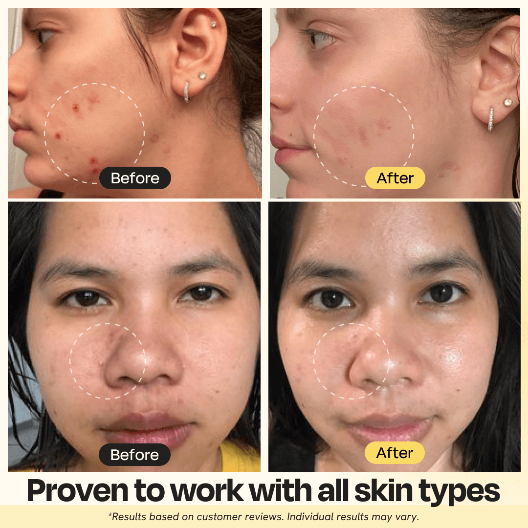 Vitamin C Clay Mask results - PuraVeil